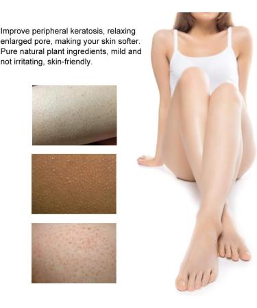 50g Keratosis Pilaris Cream Professional Smoothing Cream Body Chicken Skin Soothing Treatment Body Care Cream Rough Skin Cream Hair Follicle Repairing Chicken Skin Smoothing Body Cream - Buy Online on GoSupps.com