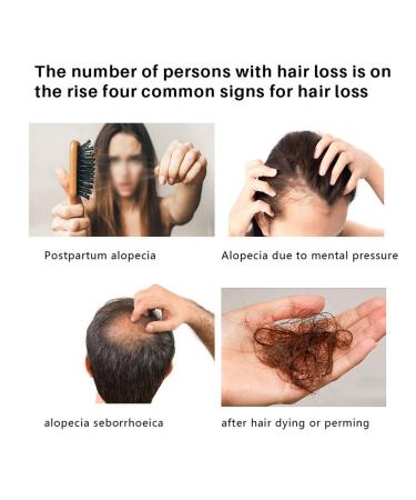 Hair Growth Serum - 30ml Moisturizing Spray for Thinning & Loss | Effective Hair Treatment & Reinforcement - Buy Online on GoSupps.com
