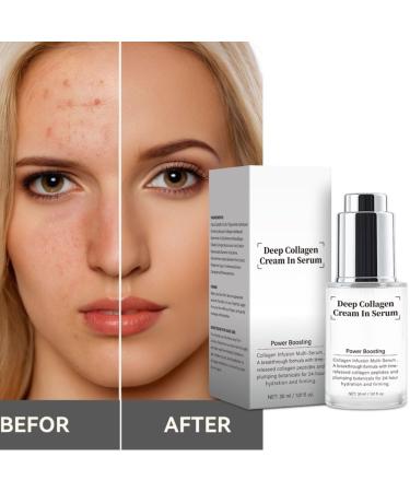 2PCS Collagen Anti Wrinkle Serum Fast Absorbing Non Sticky Moisturizing Strengthen Skin Barrier Skin Tightening 30ml - Buy Online on GoSupps.com