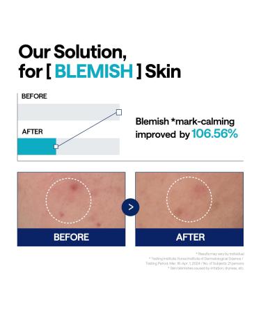 Mediheal Madecassoside Repair Serum 1.35 fl.oz - Blemish Care Fades Pigmentation and Freckles & Skin Soothing & Hydration - with Centella Asiatica Niacinamide - Buy Online on GoSupps.com