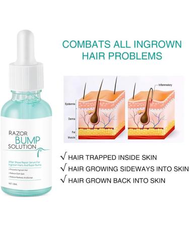  Katutude Katutude Aftershave Repair Serum 30ml Hair Growth Inhibitor Hair Growth Inhibitor Repair Serum Hair Growth Inhibitor Essence Moisturizing Hair Removal Spray for Legs of Arms - Buy Online on GoSupps.com