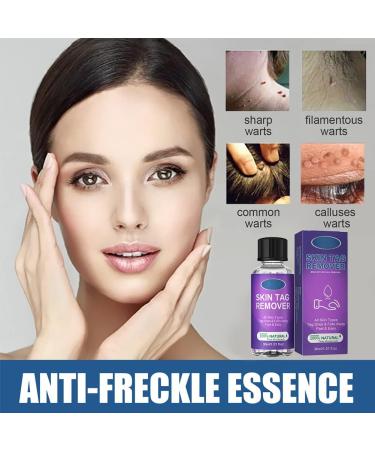 LDREAMAM Skin Tag Removal Gel - Safe & Effective Mole & Wart Remover - Buy Online on GoSupps.com