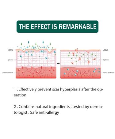 Scar Repair Serum - Effective Treatment for Old and New Scars | Men and Women | 2pcs - Buy Online on GoSupps.com