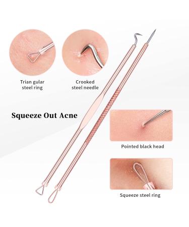 Ducare Blackhead Remover Set - 4-Piece Professional Comedone Extractor Kit for Acne & Pimples - Gold Facial Care Case - Buy Online on GoSupps.com