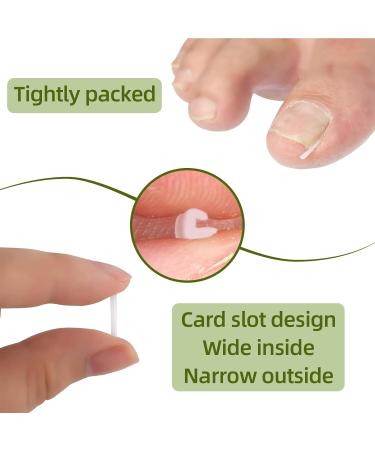 (12 +3) Ingrown Toenail Correction Treatment Kit Toenail Straightener Strips Recover Clips Plastics Ingrown Toenail Correction Strips Brace Kit for Women Men Ingrown Thick Nail - Buy Online on GoSupps.com