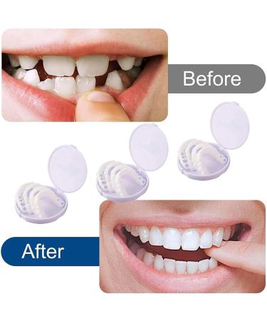 Shop High-Quality Temporary Teeth Braces - 3 Pairs of Press-on Veneers & Dentures for a Perfect Smile | International Shipping Available - Buy Online on GoSupps.com