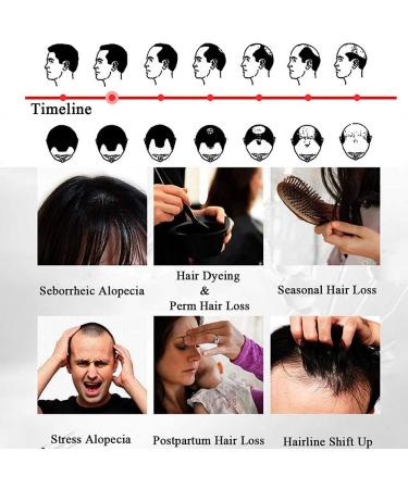 20ml Hair Growth Serum Hair Regrowth Spray Hair Growth Accelerator Wild Growth Hair Ginger Oil for Hair Loss Treatments Men Hair Growt Products - Buy Online on GoSupps.com