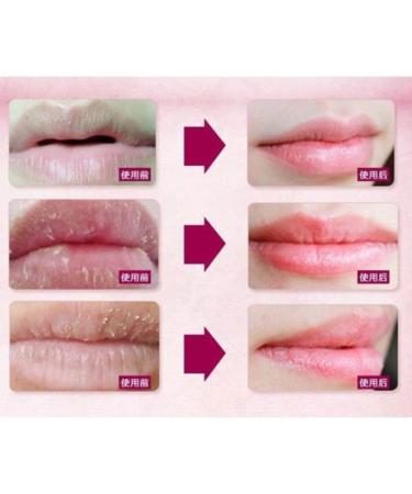 Buy 5 Pack 24K Gold Collagen Lip Treatment Masks | Hydrating Anti-Aging Lip Patches for Plumper Softer Lips - Buy Online on GoSupps.com