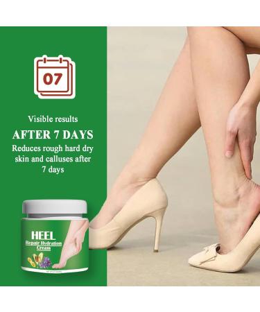 TBeautfave Cracked Heel Repair Cream Intensive Moisturiser Foot Cream for Calluses and Hard Skin Nourishing Rough and Cracked Heels Foot Moisturiser for Women & Men - Buy Online on GoSupps.com