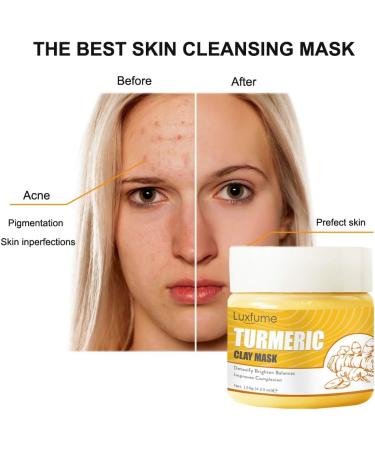 Turmeric Clay Face Mask 100% Natural Kaolin Clay Mask with Brush&Headband Skin Brightening Detoxifying Nourishing Healing Mud Masque for Dark Spots Hyperpigmentation Lightening Acne Scars - Buy Online on GoSupps.com