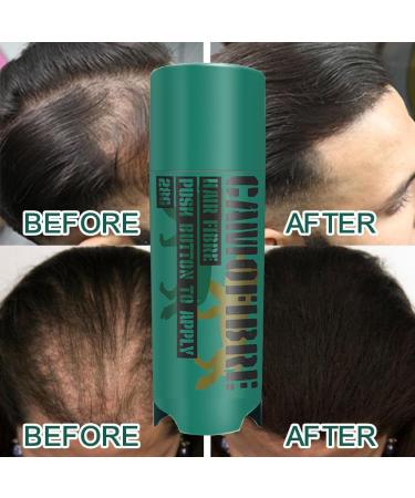 Camofibre Hair Building Fibers Premium Quality Fibre Hair Powder Spray Hair Fibres - Hair Loss Concealer for Men and Women - Bald Spots & Thinning Hair (Dark Brown) - Buy Online on GoSupps.com