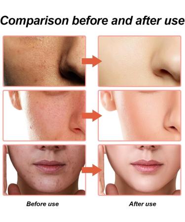TUKNN Hyaluronic Acid Dark Spot Remover for Face Hyaluronic Acid Serum for hydrated Hyalu B5 Serum Hyaluronic Acid Serum for Face Anti Aging Serum for Face Hyaluronic Acid Hydrating Serum 30ml - Buy Online on GoSupps.com