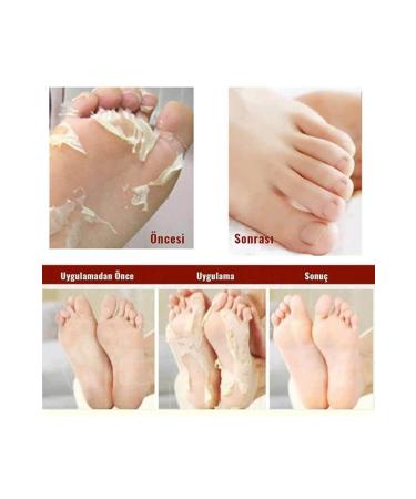 MJCARE Miracle FUE Pack - Intensive Repair Socke Mask for Rough Skin & Peel-off Cornea Remover | International Shipping - Buy Online on GoSupps.com