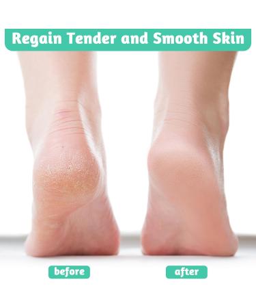 8 in 1 Pedicure Sets for Feet Foot Files for Hard Skin Foot Scraper Callus Remover for Hard Dead Skin Cracked Heels - Buy Online on GoSupps.com