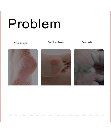 Electronic Foot File Pedicure Tool Waterproof Dead Skin Remover for Feet (Narootesacogy01tm-12) - Buy Online on GoSupps.com