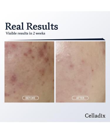 Skin Balancing pH 5.5 Toner Mist | Hydrating Acne Soothing Spray | Korean Toner with Glacier Water | 4.05 fl.oz - Buy Online on GoSupps.com