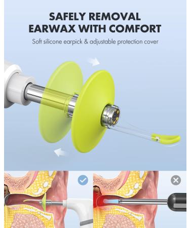 Anykit Wireless Otoscope Ear Camera - Dual View 3.9mm 720PHD WiFi Ear Scope with Ear Wax Removal Tool for Kids, Adults & Pets - Compatible with Android and iPhone - Buy Online on GoSupps.com