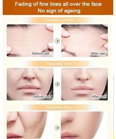 Ginseng Extract Liquid Ginseng Anti-Wrinkle Essence Toner Ginseng Extract Anti-Wrinkle Serum Korean Red Ginseng Anti Aging Essence Ginseng Face Serum Reduces Wrinkles (Color : 1pc) - Buy Online on GoSupps.com