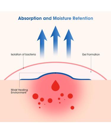 Hydrocolloid Dressings 10x10 cm - Waterproof Adhesive Wound Care for Light Exudate Acne & Bubbles - 10 Pieces 1.2 mm Thick - Buy Online on GoSupps.com