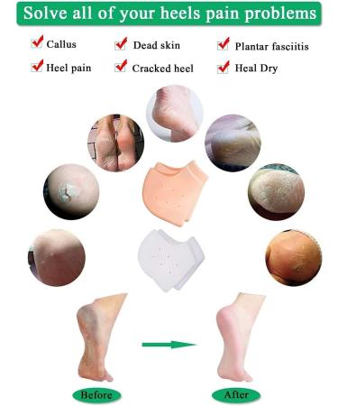 Buy Silicone Heel Covers & Moisturizing Cushions - Anti-Crack Protection for Men & Women - 2 Pairs - International Shipping Available - Buy Online on GoSupps.com