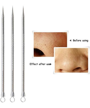 Acne Needle Stainless Steel Comedone Acne Blackhead Remover Needles Pimple Blemish Black Dots Skin Face Care Tools Clip Spoon Kit (Color : Peach) - Buy Online on GoSupps.com
