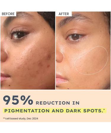 Hyphen 44% Rice Water Brightening Face Serum Pads | 5% Niacinamide & Alpha Arbutin to Reduces Dark Spots & Pigmentation | Toner Pads with Serum for Glowing Glass Skin | All Skin Types - 50N - Buy Online on GoSupps.com