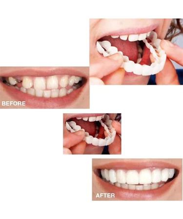 Xindinuo Snap-On Veneer Teeth - 2 Pairs | Instant Dentures for Men & Women for Confident Smile - Buy Online on GoSupps.com