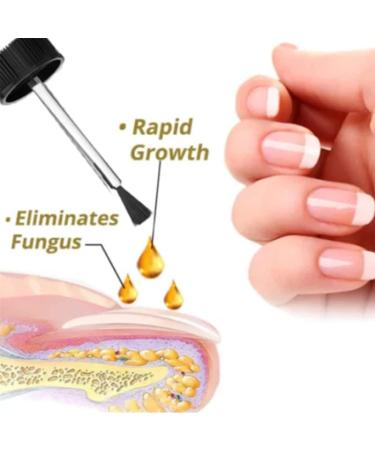 NailGro Intense Nail Growth and Strengthening Serum 7 Days Nail Growth and Strengthening Serum Natural Nail Repair Serum for Thin Nails and Growth 20ml (1Pcs) - Buy Online on GoSupps.com