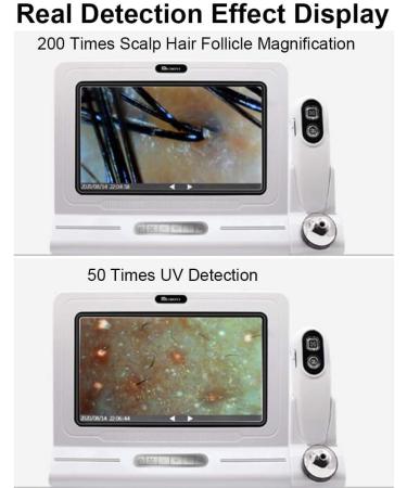 All-in-One Smart Skin And Scalp Detector With 5 Inch Screen Hair Loss Analyzer For Hair Growth - Buy Online on GoSupps.com
