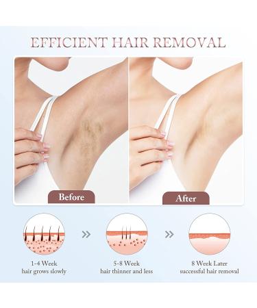 IPL Laser Hair Removal Device with Ice Compress System - Unlimited Flashes - Permanently Reduces Body & Facial Hair - Rose Gold - Buy Online on GoSupps.com