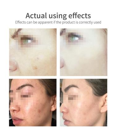 DISAAR Beauty Vitamin E Moisturizing Facial Wash Sunflowers Oil Cleans Pores Skin Smooth 100ml/3.38fi.oz - Buy Online on GoSupps.com