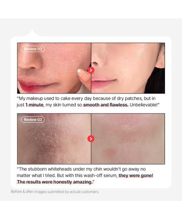 Parnell AHA 9.12% Omija Ceramic Wash-Off Serum | 1-Minute Face Exfoliation for Sebum Control & Smooth Texture | PHA BHA LHA Vitamin C K-Care (1.01 fl oz) - Buy Online on GoSupps.com