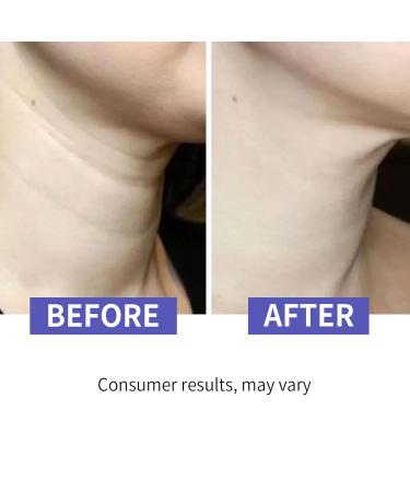 Neck Firming Cream - Advanced Anti-Aging Cream for Tightening Wrinkle Reduction & Even Skin Tone | Repair Complex for Decolletage & Double Chin - Buy Online on GoSupps.com