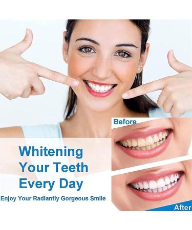 Body Accel Whitening Toothpaste - Bright White Cavity Repair & Fresh Breath (3PCs) - International Shipping Available - Buy Online on GoSupps.com