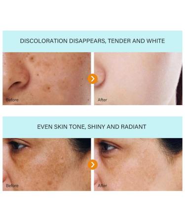 Go Ho Skin Whitening Cream | Skin Bleaching & Dark Spot Remover for Face & Body | Lightening Cream for Intimate Areas Armpits Knees & Elbows | 1.06oz - Buy Online on GoSupps.com