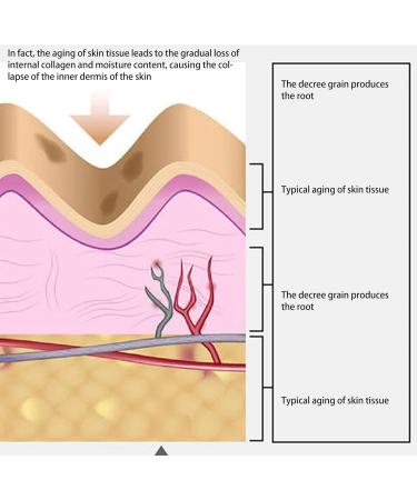 5 Pairs Nasolabial Folds Patch 4d Moisturize Firming Skin Face Wrinkle Patches for Man Woman Cheek Wrinkle Patch for Young Look - Buy Online on GoSupps.com