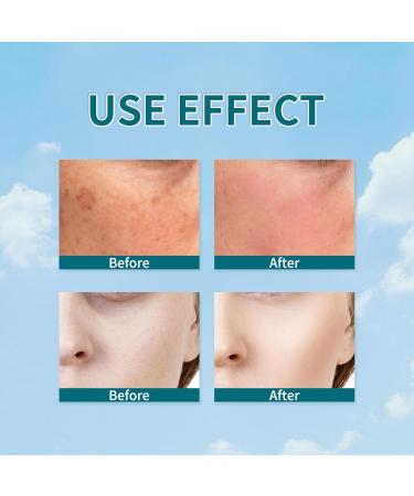 Dark S Corrector Cream Whiten S Moisturizer Skin Brightening Cream Facial Brightening Moisturizer Deep Skin Brightening Skin Tone Corrector Dark Remover Age S Cream - Buy Online on GoSupps.com