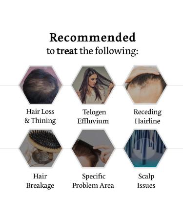 Follicution Dry Scalp Treatment | Roll-On Moisturizer & Hair Growth Serum for Men & Women | Natural Itchy Scalp Relief & Thickening Treatment - BallVic - Buy Online on GoSupps.com