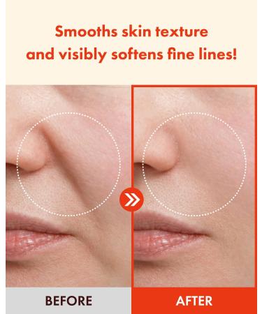 It'S SKIN Retinoidin Cream - Retinol Anti Aging Face Moisturizer - Smooth Wrinkles & Fine Lines - Firming & Moisturizing with Adenosine Hyluronic Acid Peptides Niacinamide and Ceramide 3.38 oz. - Buy Online on GoSupps.com