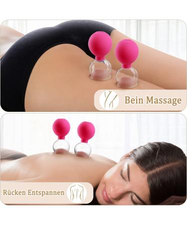 High-Quality Pink Cupping Glass Set - 5 Real Glass Cups with TPU Suction Ball for Targeted Relaxation & Well-Being - International Shipping Available - Buy Online on GoSupps.com