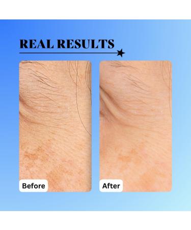 10% Glycolic Exfoliating Treatment Tonic (1oz) 1 Ounce (Pack of 1) - Buy Online on GoSupps.com