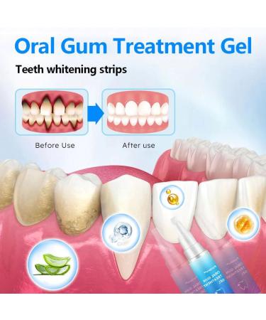 Remove Oral Gum Treatment Gel - Tooth Elevator Essence Pin & Protection - 3 PCs for Gum Residue Stains & Tartar Removal - Buy Online on GoSupps.com