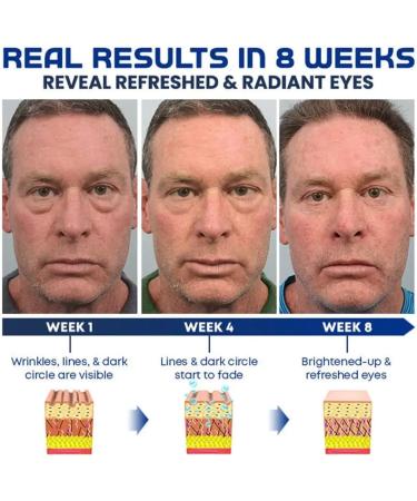 Himse Awaken Peptide Depuffing Eye Gel Reduces Puffiness Dark Circles Under Eye Bags Wrinkles and Fine Lines Around Eyes Moisturizing Eye Cream for Men (1 Pcs) - Buy Online on GoSupps.com