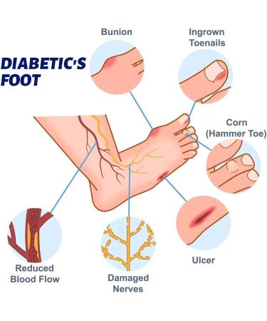  Mimoqk Foot Cream Cracked Heel Balm 20g Soothing Non Greasy Moisturizer for Athlete Travel Knee Care Skin Health Repair Relief Softening Hydrating Overnight Use Multicolor - Buy Online on GoSupps.com