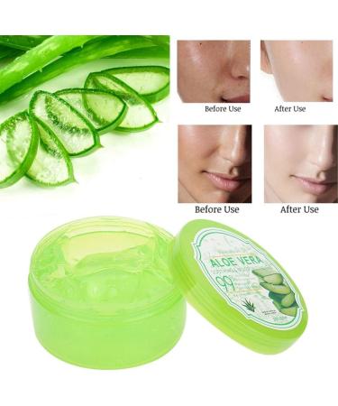 300G Organic Aloe Vera Gel Moisturizer For Damaged Skin Relieves Acne Scars And Redness Dry Storage For And Sunburned Rough Skin - Buy Online on GoSupps.com