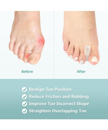 Silicone Toe Separator & Bunion Corrector - 12-Pack Toe Spacers for Overlapping Toe & Hammer Toe Relief - Best for Women & Men - Buy Online on GoSupps.com
