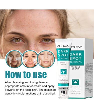 Dark Spot Correcting Serum - Best Dark Spot Remover for Age Spots Sun Spots & Freckles - 30g Body Cream - Buy Online on GoSupps.com