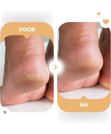 CTEC IK 8 Set Moisturizing and Repairing Foot and Hand Cream Kombucha Hyaluronic Acid and Niacinamide All skin types Without parabens or sulphates 2x100g - Buy Online on GoSupps.com