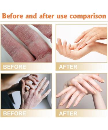 HAPPYWOO Hydrating Hand Cream with Horse Oil Hand Care Antifreeze Anti-Crack Moisturizing Refreshing and Non-Greasy - Buy Online on GoSupps.com