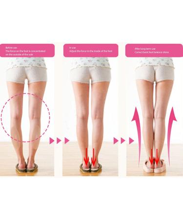 4.2oz Adhesive Leg Corrector | Portable Silicone Calf Pad for Crooked & Thin Legs | Soft Beige Adhesive Support - Buy Online on GoSupps.com